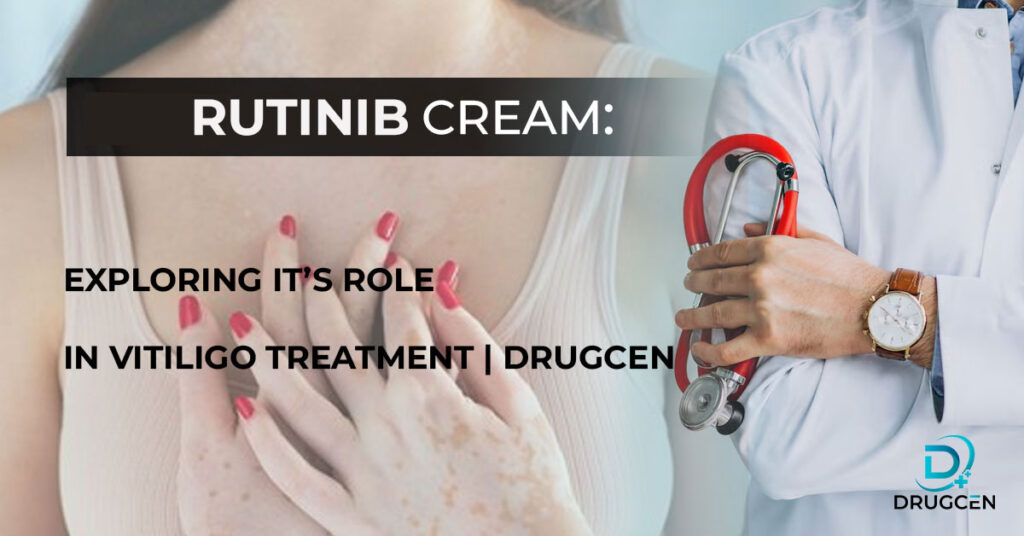 Doctor standing in the foreground, with a woman affected by vitiligo in the background. With text 'Rutinib cream: role of it in vitiligo treatment